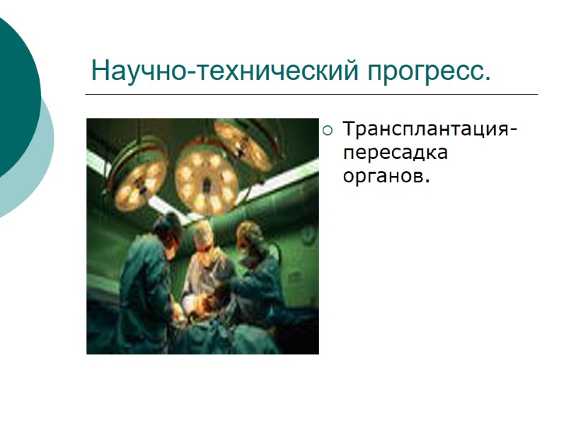 Научно-технический прогресс. Трансплантация- пересадка органов.